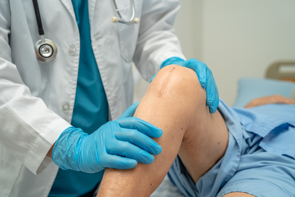 Total Knee Replacement Surgery